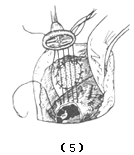 �ļ��������������رղ�ȫ