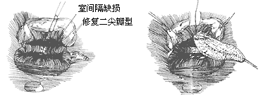 ���ҹܻ���