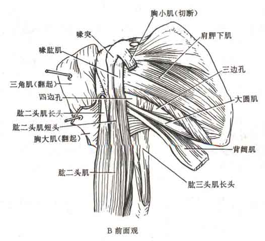 在肩袖中,冈上肌最易撕裂,因其位于肩袖的顶点,同时又位于肩峰及喙肩