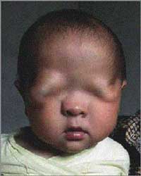 �ر��ע�����ۻ����ȴ�ȫ��ר���ǵ�Ԯ��//