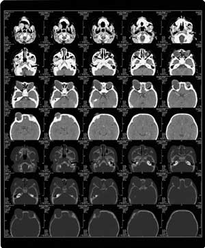 �ر��ע�����ۻ����ȴ�ȫ��ר���ǵ�Ԯ��//