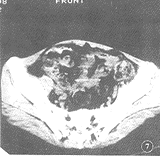 t4707.gif (7555 bytes)