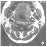 tb807.gif (8323 �ֽ�)