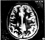 t10701.gif (5328 bytes)