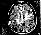 t10702.gif (6156 bytes)