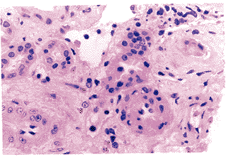 t15-4.gif (15728 bytes)