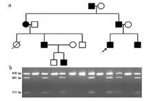 �ٴ��������ۡ����Ŵ��Դ����Ա�Ƥ�ɽ�֢/����ժҪ/��������/