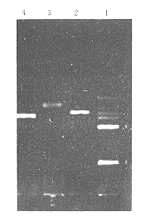 ෢ӲѪϸ IL-2TGF- mRNAо