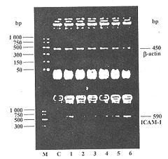 СӹĤICAM-1 mRNAıＰ