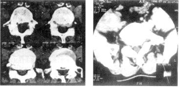 ׵֢CT