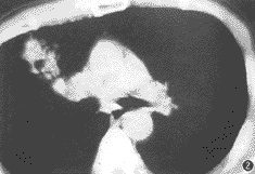 ��35�������ҷ��Ű�Ƭ״����Ӱ