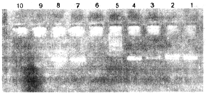 þۺøӦۺѪȻѪк̹RNA