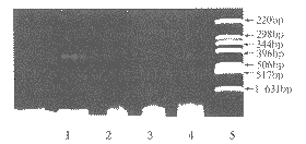 ת¼鵼HSV1-TKGRC-1ϸеı