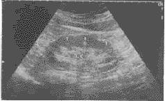 �����ʴ󼰷�Ҷ������18������