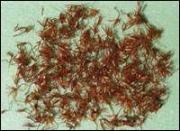 �컨(��Ѫͨ����ȥ��ֹʹ)