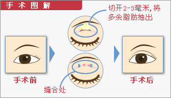 ʲô��������