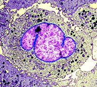 NSCLC׵ҩЧ