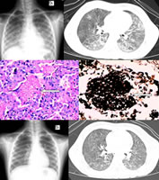 ���ܰ�Ѫ���������Ϸ����ӳ����һ��