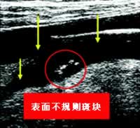 ISC2007��ᱨ�������ȱѪ������Σ������